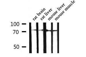 Western blot analysis of extracts from rat brain ,rat liver,mouse liver,mouse muscle, using GARS Antibody. (GARS 抗体  (C-Term))