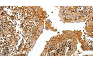 Immunohistochemistry of paraffin-embedded Human tonsil tissue using TNR Polyclonal Antibody at dilution 1:60 (Tenascin R 抗体)