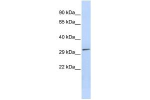 WB Suggested Anti-PDXP Antibody Titration: 0. (PDXP 抗体  (Middle Region))