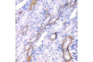 Immunohistochemistry of paraffin-embedded rat kidney using MYO1C antibody at dilution of 1:100 (x40 lens). (Myosin IC 抗体)