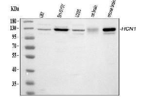 Western blot analysis of HCN1 using anti-HCN1 antibody (ABIN3042439).