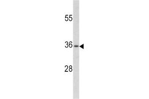 Western Blotting (WB) image for anti-Paired Box 4 (PAX4) antibody (ABIN3002750) (PAX4 抗体)