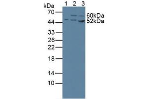 Western blot analysis of (1) Human 293T Cells, (2) Human HeLa cells and (3) Human HepG2 Cells. (CS 抗体  (AA 103-394))