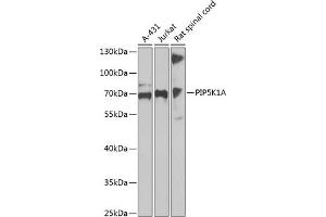 Western blot analysis of extracts of various cell lines, using PIP5K1A antibody  at 1:1000 dilution. (PIP5K1A 抗体  (AA 231-500))