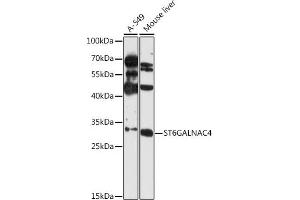 Western blot analysis of extracts of various cell lines, using ST6G antibody (ABIN6131358, ABIN6148539, ABIN6148540 and ABIN6216674) at 1:3000 dilution. (ST6GALNAC4 抗体  (AA 120-210))