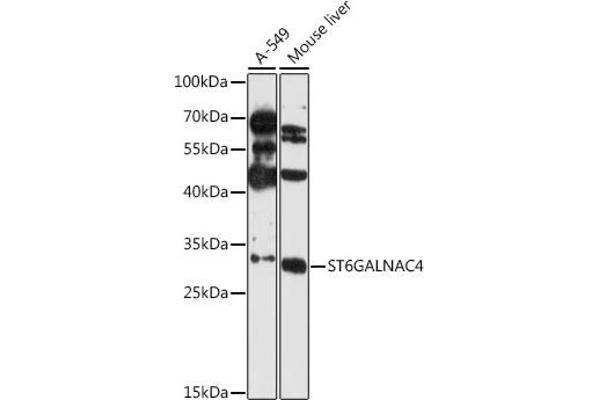 ST6GALNAC4 抗体  (AA 120-210)