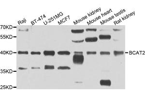 Western blot analysis of extracts of various cell lines, using BCAT2 antibody. (BCAT2 抗体)