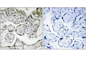 Immunohistochemistry analysis of paraffin-embedded human placenta tissue, using ME2 Antibody. (NAD-ME 抗体  (AA 201-250))