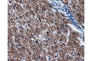 Immunohistochemical staining of paraffin-embedded liver tissue using anti-FAHD2Amouse monoclonal antibody. (FAHD2A 抗体)