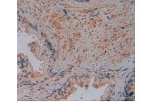 IHC-P analysis of Human Prostate Gland Tissue, with DAB staining.