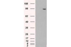 Image no. 14 for anti-TYRO3 Protein Tyrosine Kinase (TYRO3) antibody (ABIN1501606) (TYRO3 抗体)