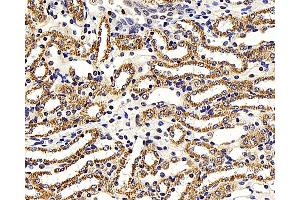 Immunohistochemistry analysis of paraffin-embedded mouse kidney using NFKBIB Polyclonal Antibody at dilution of 1:300. (NFKBIB 抗体)