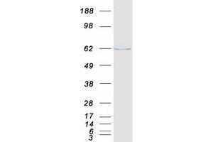 Western Blotting (WB) image for Phosphodiesterase 1A (PDE1A) (Transcript Variant 1) protein (Myc-DYKDDDDK Tag) (ABIN2728480)