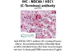 Image no. 1 for anti-NDC80 Kinetochore Complex Component Homolog (NDC80) (C-Term) antibody (ABIN1737233) (NDC80 抗体  (C-Term))