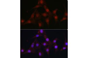 Immunofluorescence analysis of NIH/3T3 cells using C9orf72 Rabbit pAb (ABIN7266391) at dilution of 1:100 (40x lens). (C9ORF72 抗体  (AA 1-230))