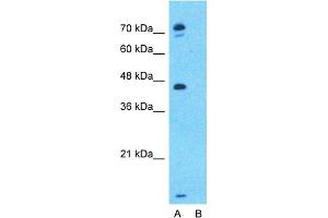 Host:  Rabbit  Target Name:  EPX  Sample Type:  MCF7  Lane A:  Primary Antibody  Lane B:  Primary Antibody + Blocking Peptide  Primary Antibody Concentration:  1ug/ml  Peptide Concentration:  5ug/ml  Lysate Quantity:  25ug/lane/lane  Gel Concentration:  0. (EPX 抗体  (Middle Region))