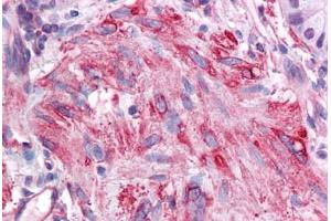 Human Small Intestine, Muscularis Mucosa: Formalin-Fixed, Paraffin-Embedded (FFPE) (SIRT5 抗体  (AA 179-228))
