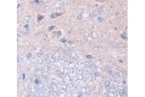 IHC-P analysis of Human Tissue, with DAB staining. (FBLN3 抗体  (AA 258-493))