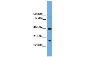 WB Suggested Anti-TREML2 Antibody Titration:  0. (TREML2 抗体  (N-Term))