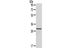 Western Blotting (WB) image for anti-HIV-1 Tat Interactive Protein 2, 30kDa (HTATIP2) antibody (ABIN5956861) (HIV-1 Tat Interactive Protein 2, 30kDa (HTATIP2) 抗体)