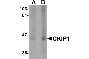 Western blot analysis of CKIP1 in human lung tissue lysate with CKIP1 antibody at (A) 1 and (B) 2 µg/mL. (PLEKHO1 抗体  (C-Term))