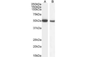 Western Blotting (WB) image for anti-Glial Fibrillary Acidic Protein (GFAP) (C-Term) antibody (ABIN185730)