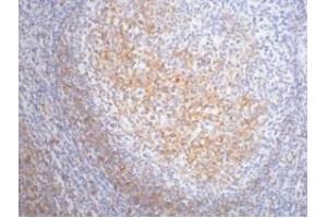Immunohistochemistry (IHC) image for anti-Fc Fragment of IgE, Low Affinity II, Receptor For (CD23) (FCER2) antibody (ABIN7189214)