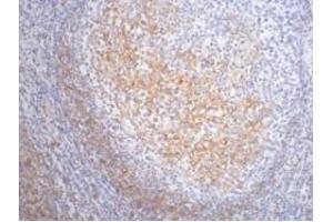 IHC staining of Human tonsil tissue paraffin-embedded, diluted at 1:200. (FCER2 抗体)