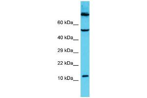 Host: Rabbit Target Name: C9orf16 Sample Type: HCT15 Whole Cell lysates Antibody Dilution: 1. (C9orf16 抗体  (Middle Region))