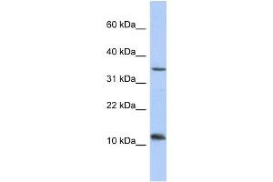 WB Suggested Anti-NXNL2 Antibody Titration: 0. (NXNL2 抗体  (Middle Region))
