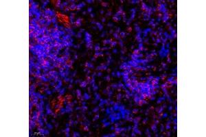 Immunofluorescence of paraffin embedded rat spleen using septin1 (ABIN7074453) at dilution of 1: 650 (400x lens)