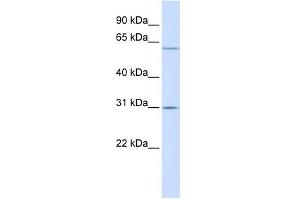 TMEM106C antibody used at 1 ug/ml to detect target protein. (TMEM106C 抗体  (Middle Region))