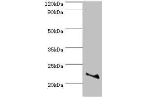 Western blot All lanes: ASF1A antibody at 2 μg/mL + Jurkat whole cell lysate Secondary Goat polyclonal to rabbit IgG at 1/10000 dilution Predicted band size: 23 kDa Observed band size: 23 kDa (ASF1A 抗体  (AA 1-204))