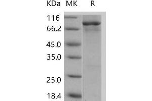 Western Blotting (WB) image for Epidermal Growth Factor Receptor (EGFR) (AA 668-1210) (Active) protein (GST tag,His tag) (ABIN7317119)