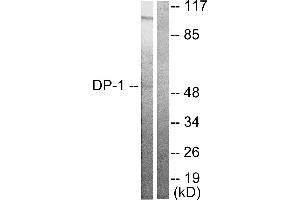 Western blot analysis of extracts from HeLa cells, using DP-1 antibody. (TGM4 抗体)