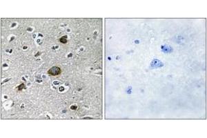 Immunohistochemistry analysis of paraffin-embedded human brain tissue, using AKAP1 Antibody. (AKAP1 抗体  (AA 281-330))