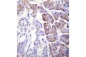 Formalin fixed and paraffin embedded human pancreas tissue stained with Carboxypeptidase B Antibody (N-term) followed by peroxidase conjugation of the secondary antibody and DAB staining. (CPB1 抗体  (N-Term))