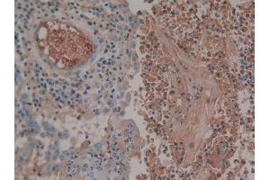 Immunohistochemistry (IHC) image for anti-Serpin Family C Member 1 (SERPINC1) antibody (ABIN7426502)