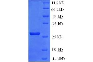 SDS-PAGE (SDS) image for Thrombospondin 2 (THBS2) (AA 19-232), (partial) protein (His tag) (ABIN5710490)