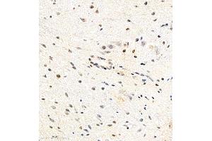 Immunohistochemistry of paraffin embedded mouse spinal cord using USP27 (ABIN7076113) at dilution of 1:700 (400x lens) (USP27X 抗体)