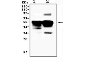 anti-S-Antigen, Retina and Pineal Gland (Arrestin) (SAG) (AA 193-405) antibody