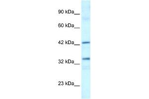 WB Suggested Anti-TAF1A Antibody Titration:  0. (TAF1A 抗体  (C-Term))