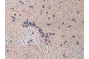 Immunohistochemistry (IHC) image for anti-Bone Morphogenetic Protein 15 (BMP15) (AA 269-391) antibody (ABIN7441844)