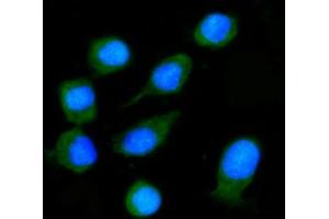 IF analysis of NXN/NRX using anti-NXN/NRX antibody (ABIN7600416). (NXN 抗体  (AA 19-435))