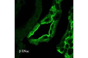 Immunohistochemistry (IHC) image for anti-Sodium Channel, Nonvoltage-Gated 1 alpha (SCNN1A) (AA 617-638) antibody (Atto 594) (ABIN2486403)