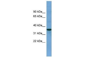 WB Suggested Anti-BACE2 Antibody Titration:  0. (BACE2 抗体  (N-Term))