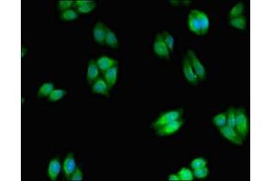 Immunofluorescent analysis of HepG2 cells using ABIN7169226 at dilution of 1:100 and Alexa Fluor 488-congugated AffiniPure Goat Anti-Rabbit IgG(H+L) (WNK2 抗体  (AA 1177-1464))