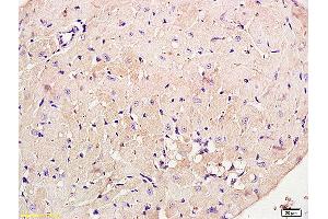 Formalin-fixed and paraffin embedded rat brain labeled with Anti phospho-PI3K p85/PIK3R1(Tyr368) Polyclonal Antibody, Unconjugated (ABIN711041) at 1:200 followed by conjugation to the secondary antibody and DAB staining (PIK3R1 抗体  (pTyr368))