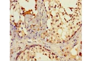 Immunohistochemistry of paraffin-embedded human testis tissue using ABIN7157004 at dilution of 1:100 (IFT80 抗体  (AA 1-268))