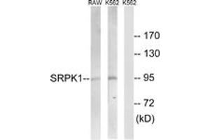 Western blot analysis of extracts from K562/RAW264. (SRPK1 抗体  (AA 521-570))